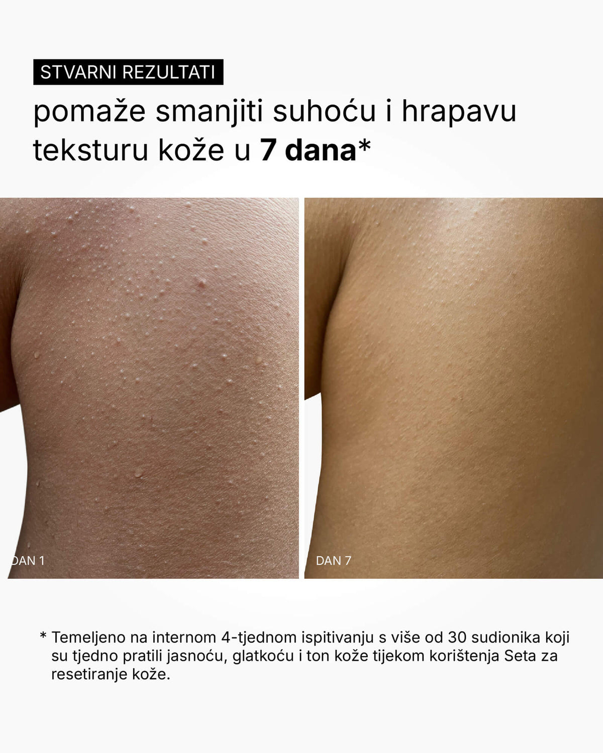 Setul Skin Reset - Rutina completă pentru corp