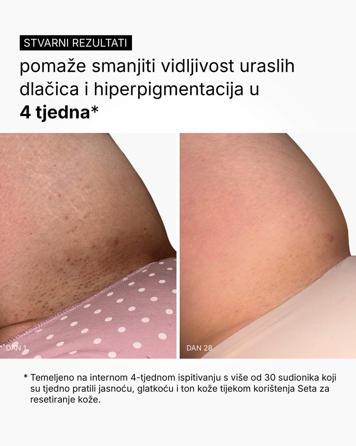 Setul Skin Reset - Rutina completă pentru corp