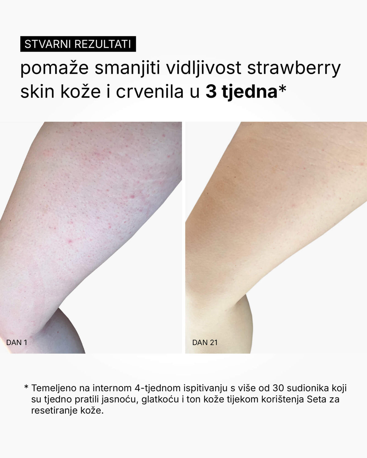 Setul Skin Reset - Rutina completă pentru corp